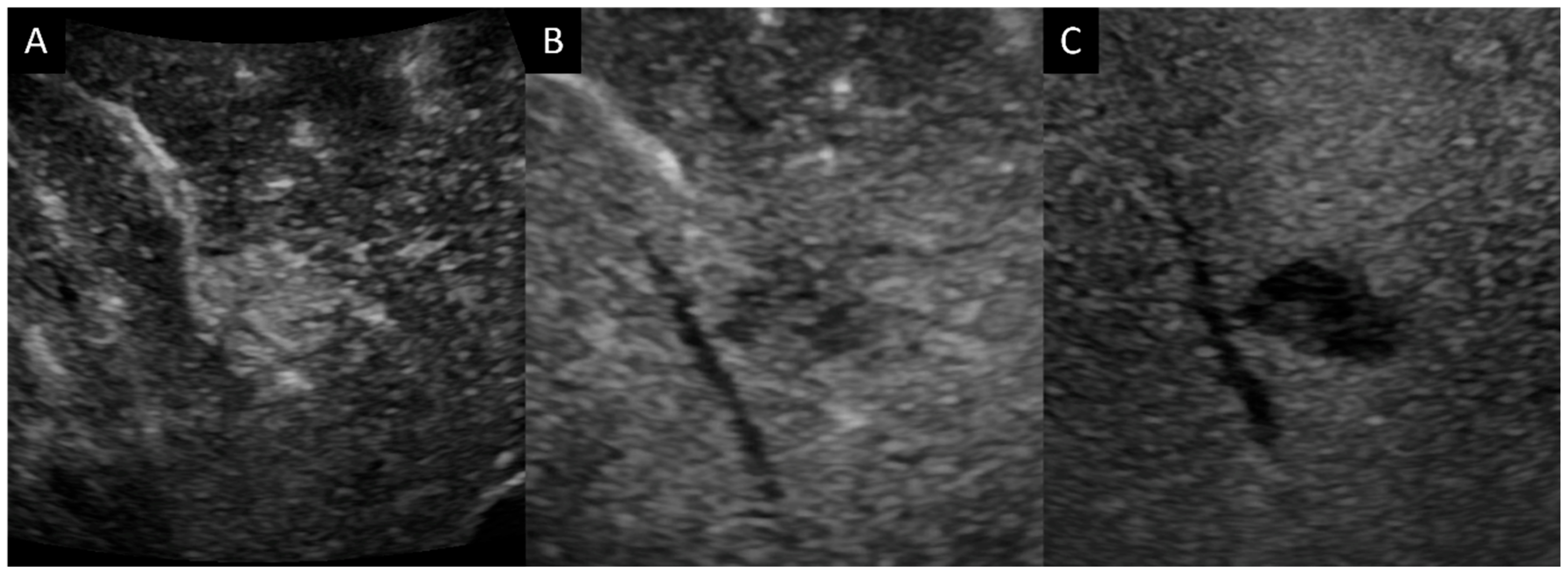 Diagnostics 14 00306 g002