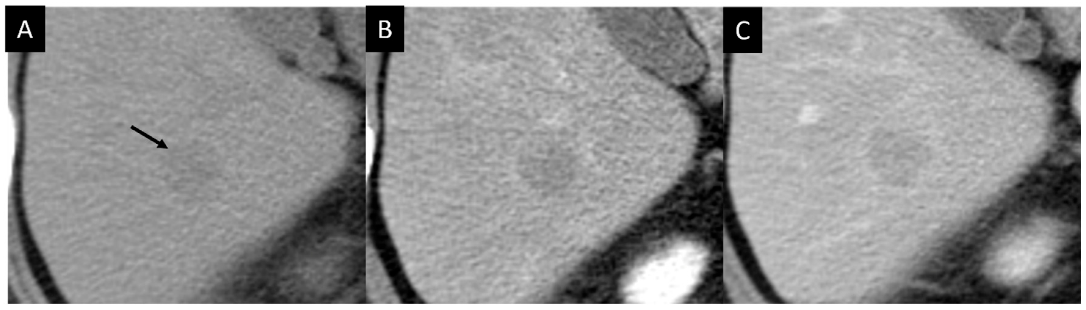 Diagnostics 14 00306 g003