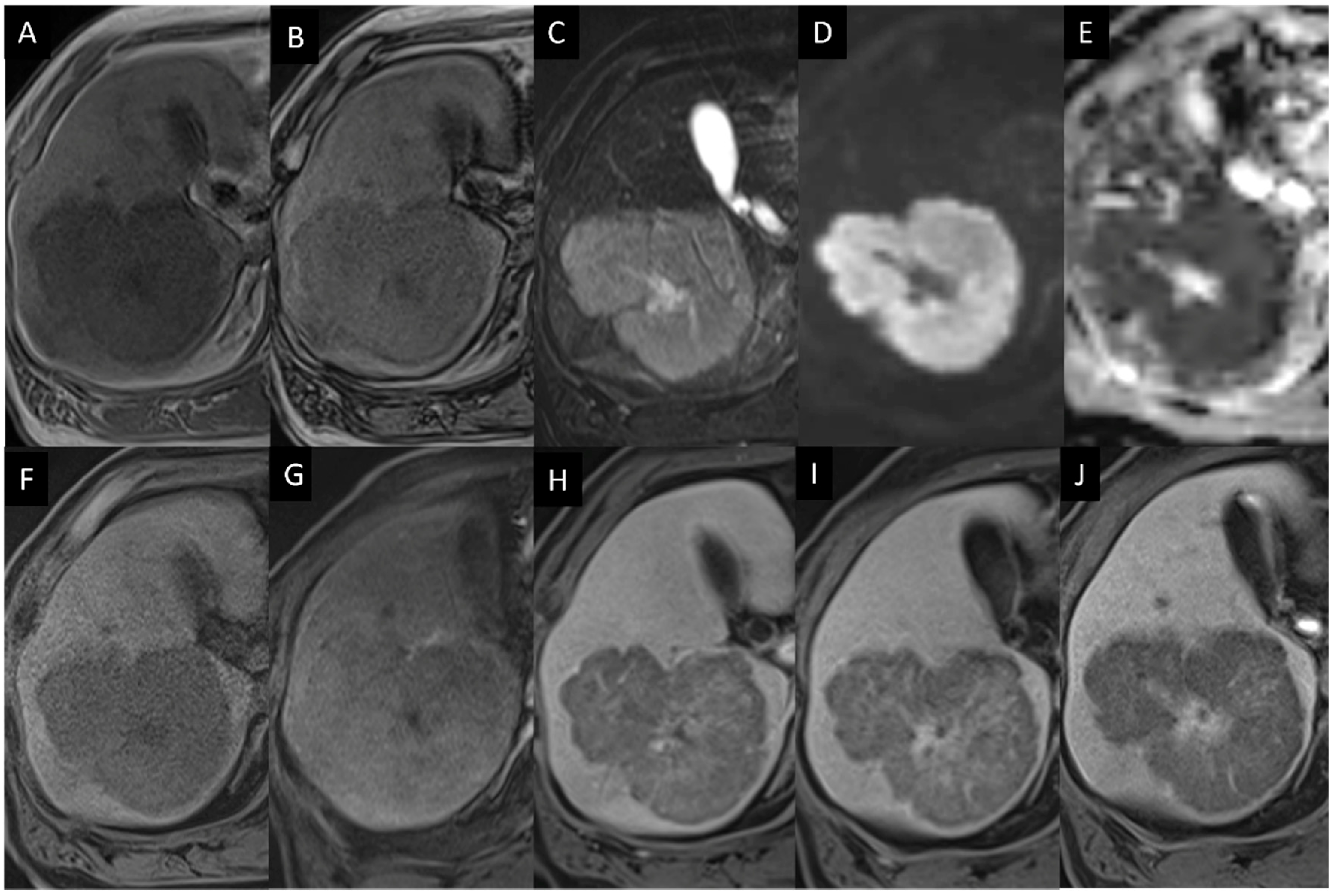 Diagnostics 14 00306 g004