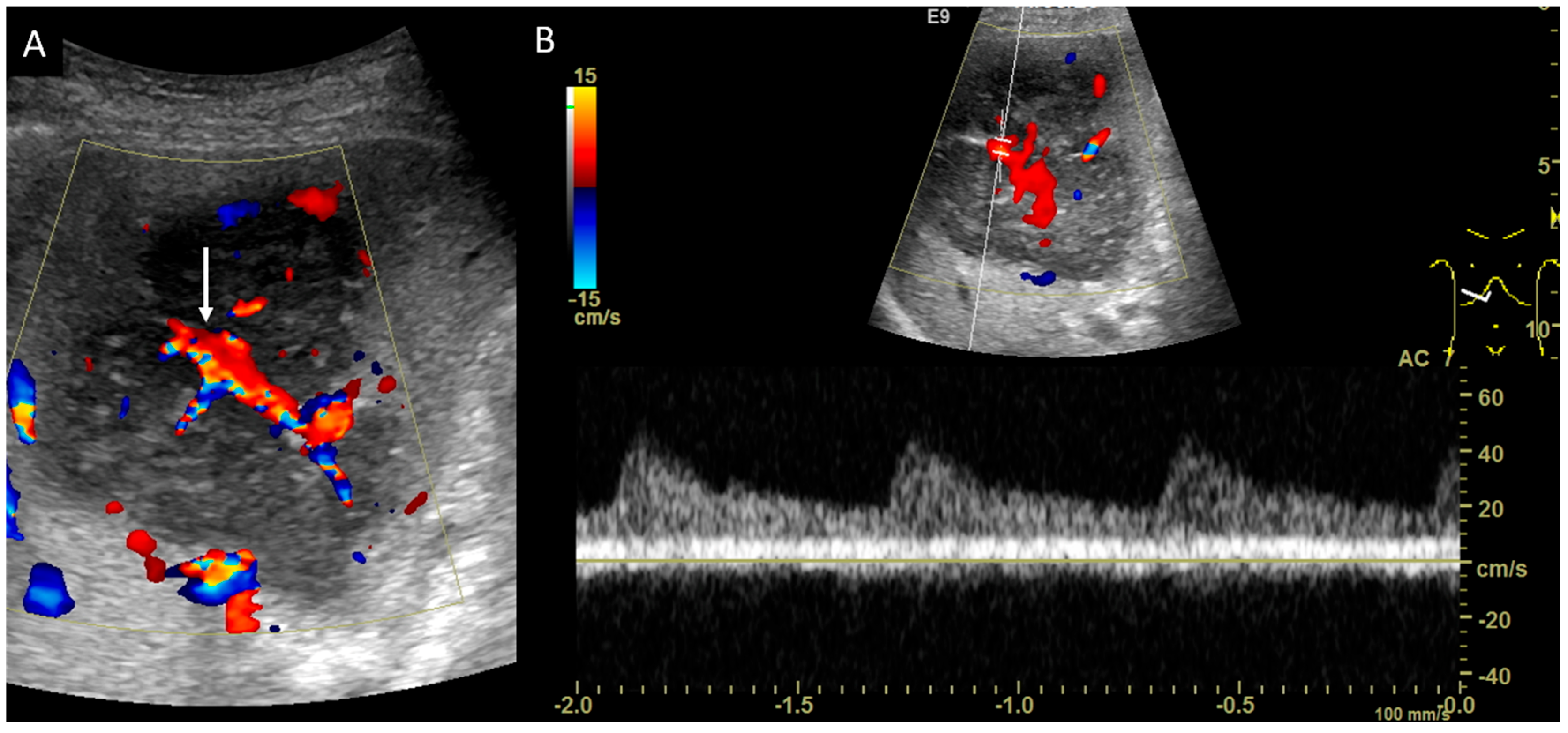 Diagnostics 14 00306 g005