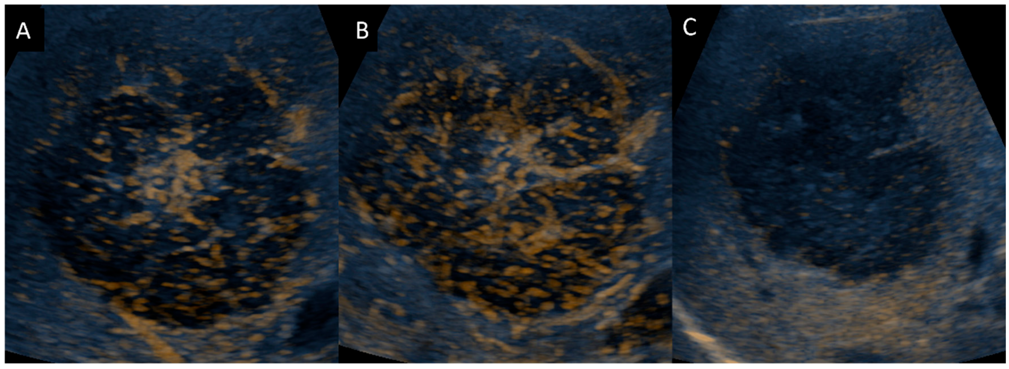 Diagnostics 14 00306 g006