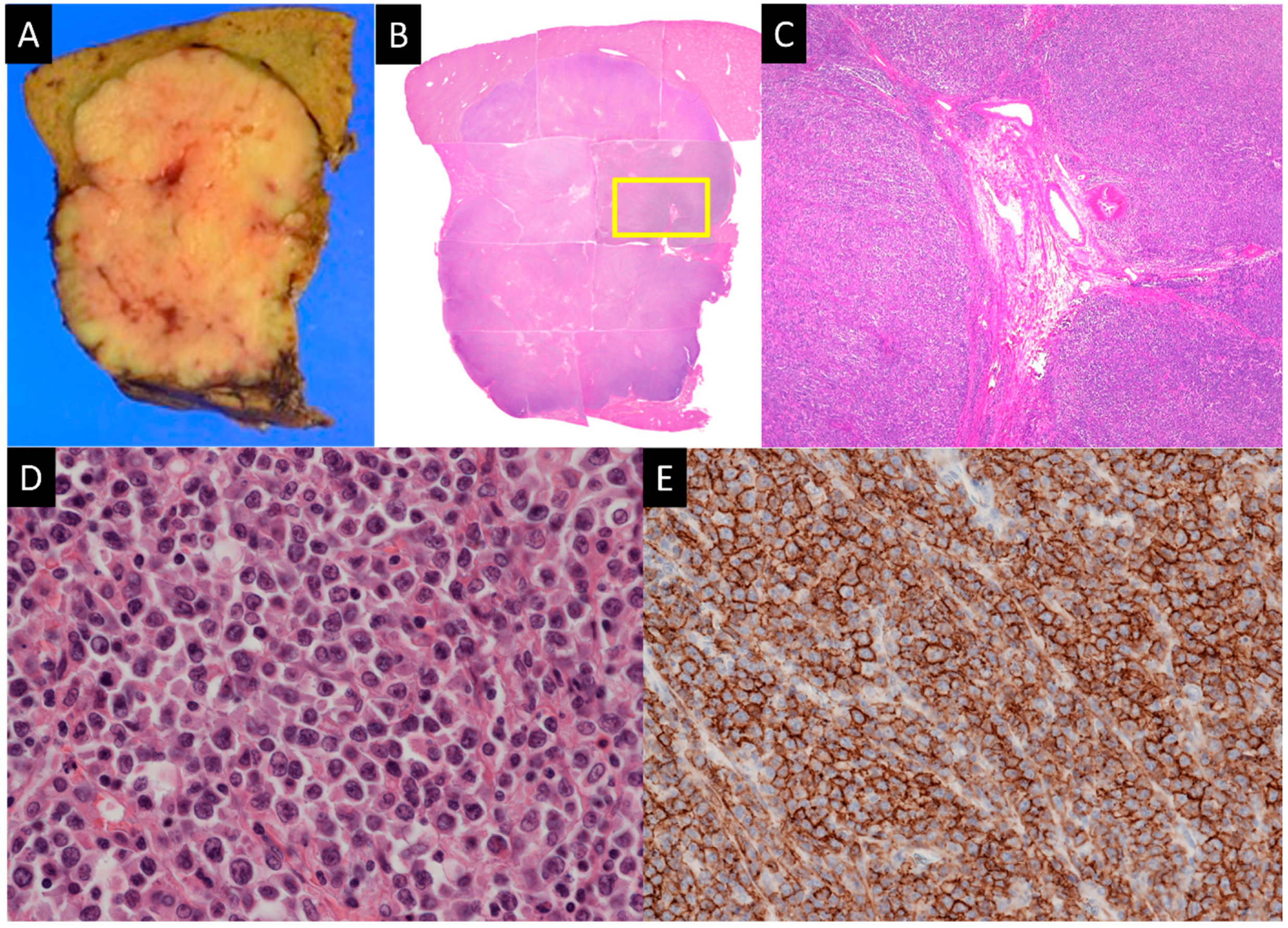 Diagnostics 14 00306 g007