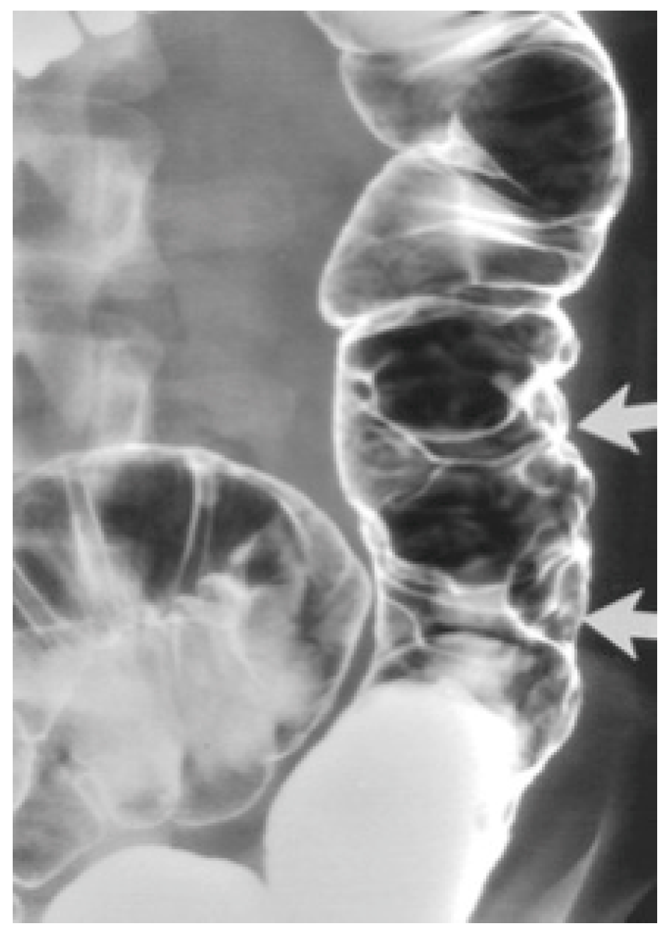 Diagnostics 14 00310 g001