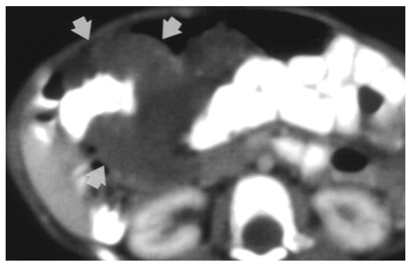 Diagnostics 14 00310 g002