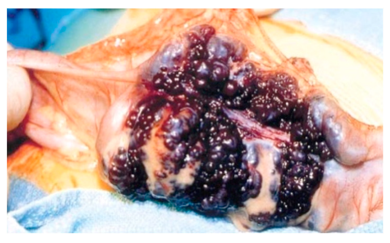 Diagnostics 14 00310 g003