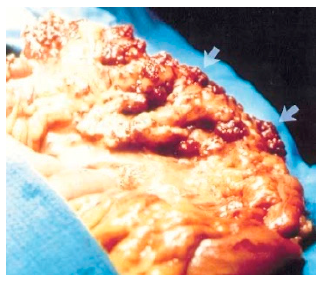 Diagnostics 14 00310 g004