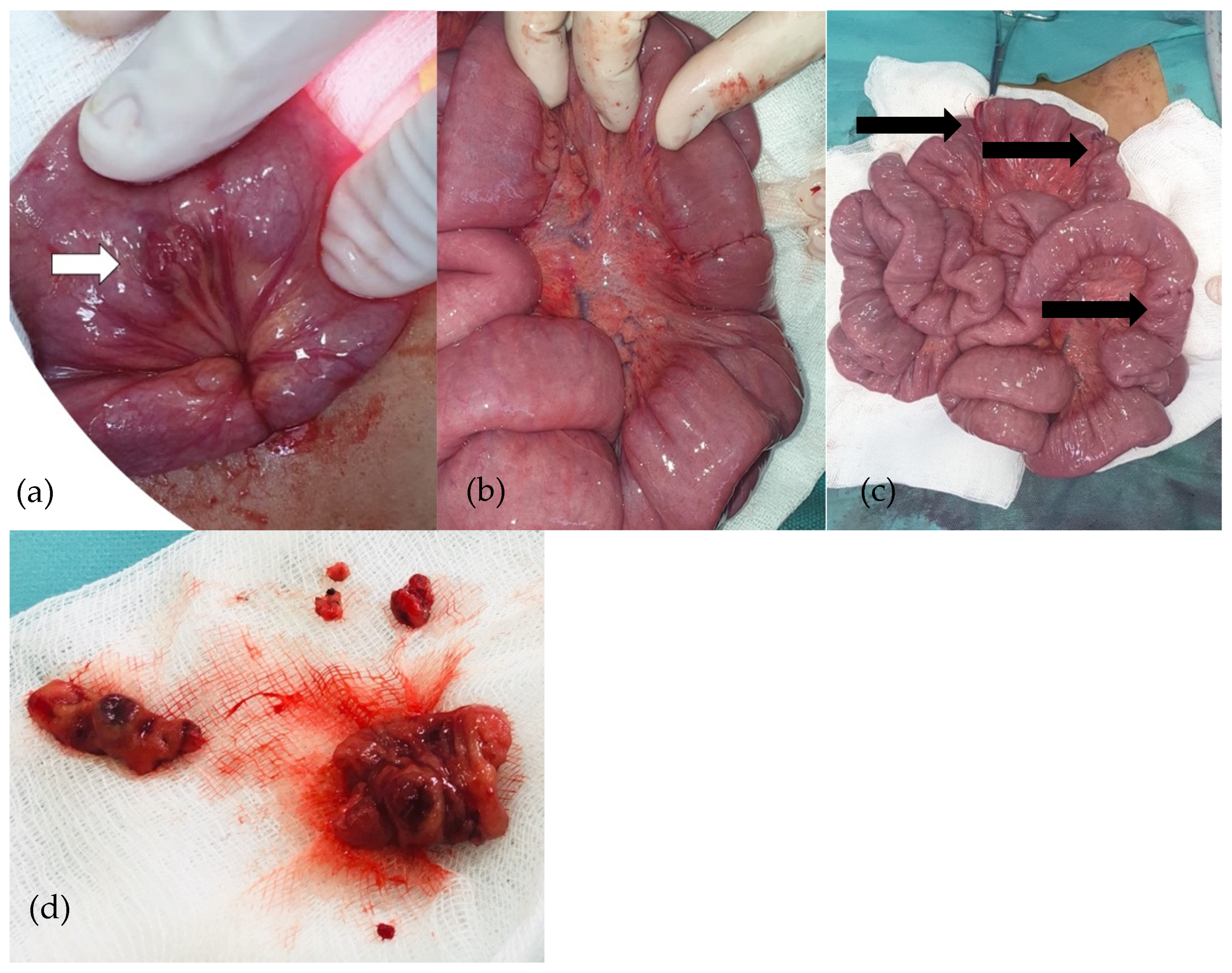 Diagnostics 14 00310 g006