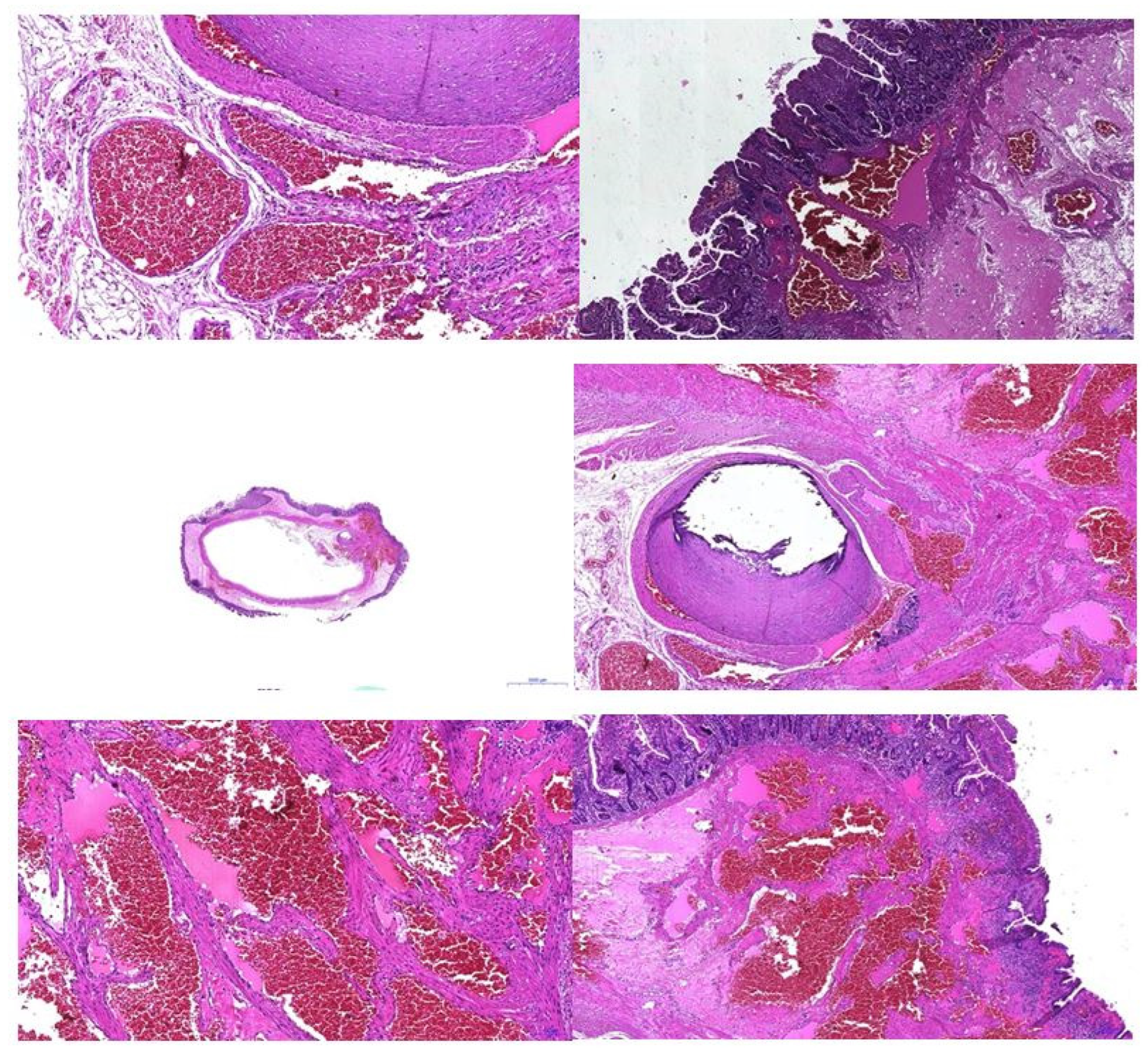 Diagnostics 14 00310 g007