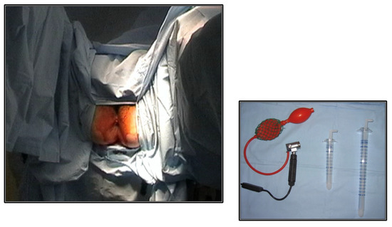 Diagnostics 14 00315 g001