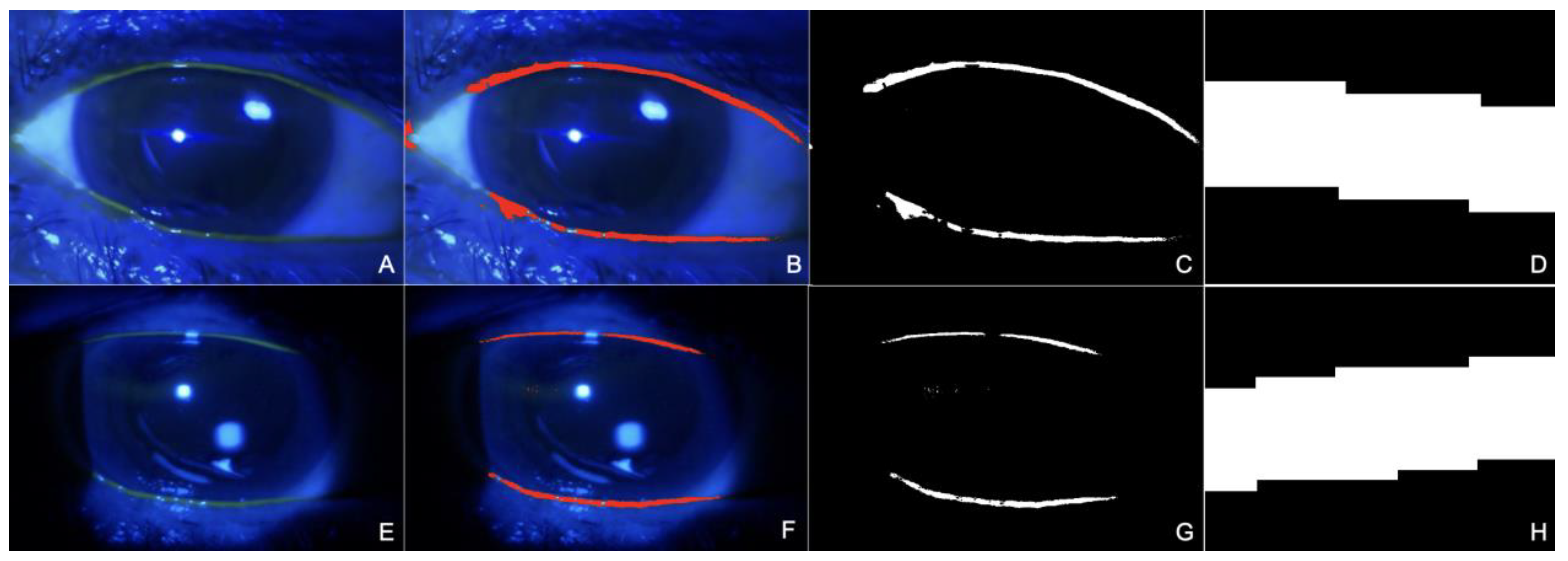 Diagnostics 14 00316 g001