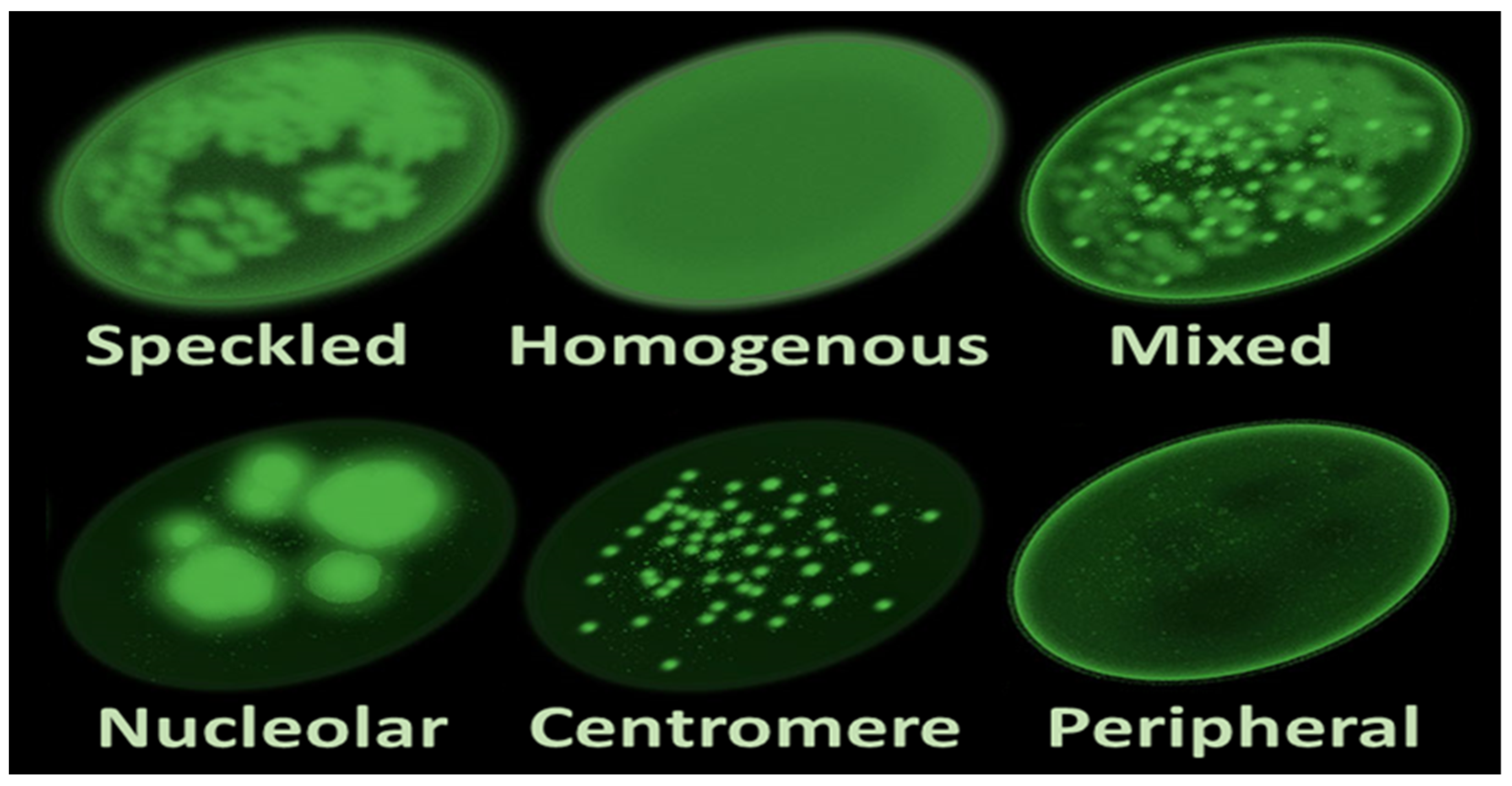 Diagnostics 14 00320 g001