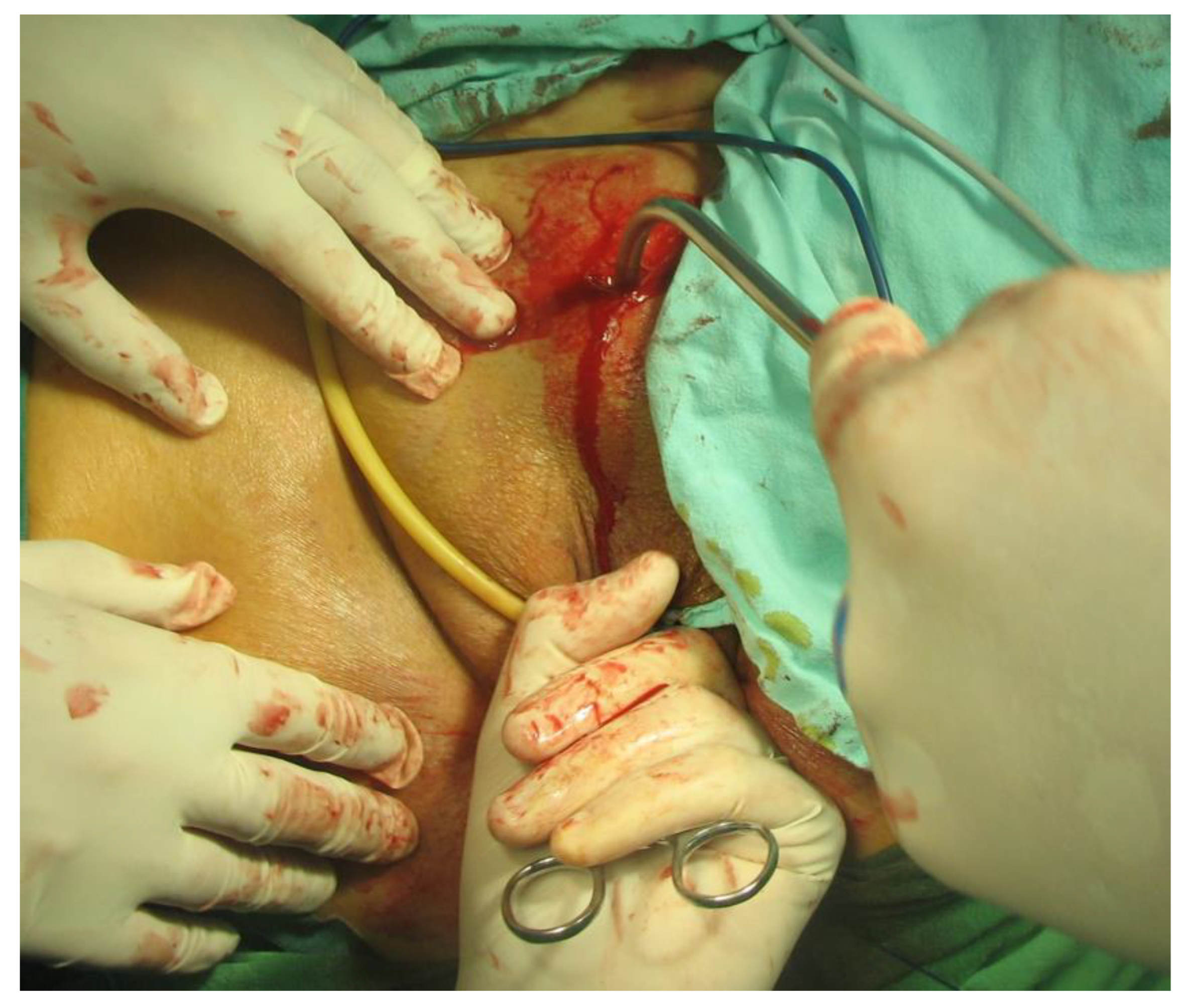 Diagnostics 14 00323 g001