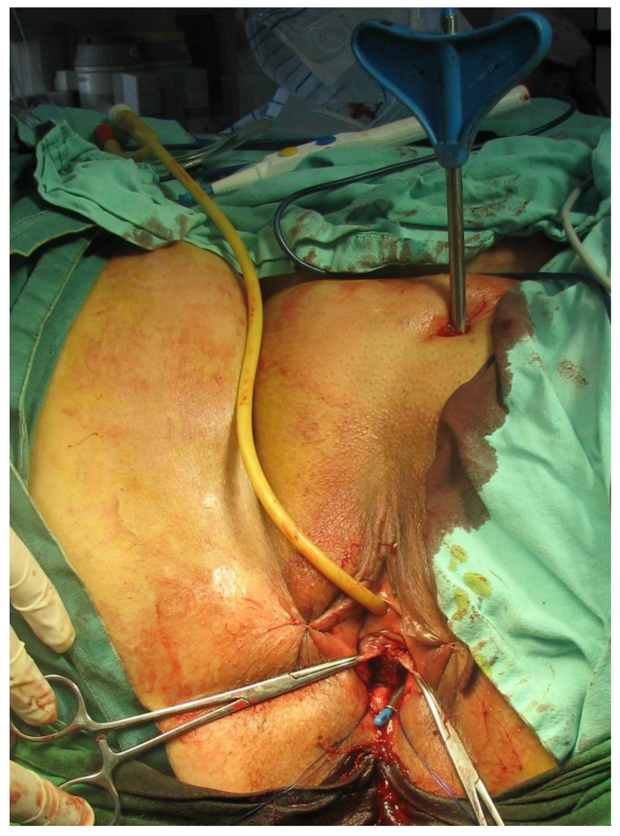 Diagnostics 14 00323 g002