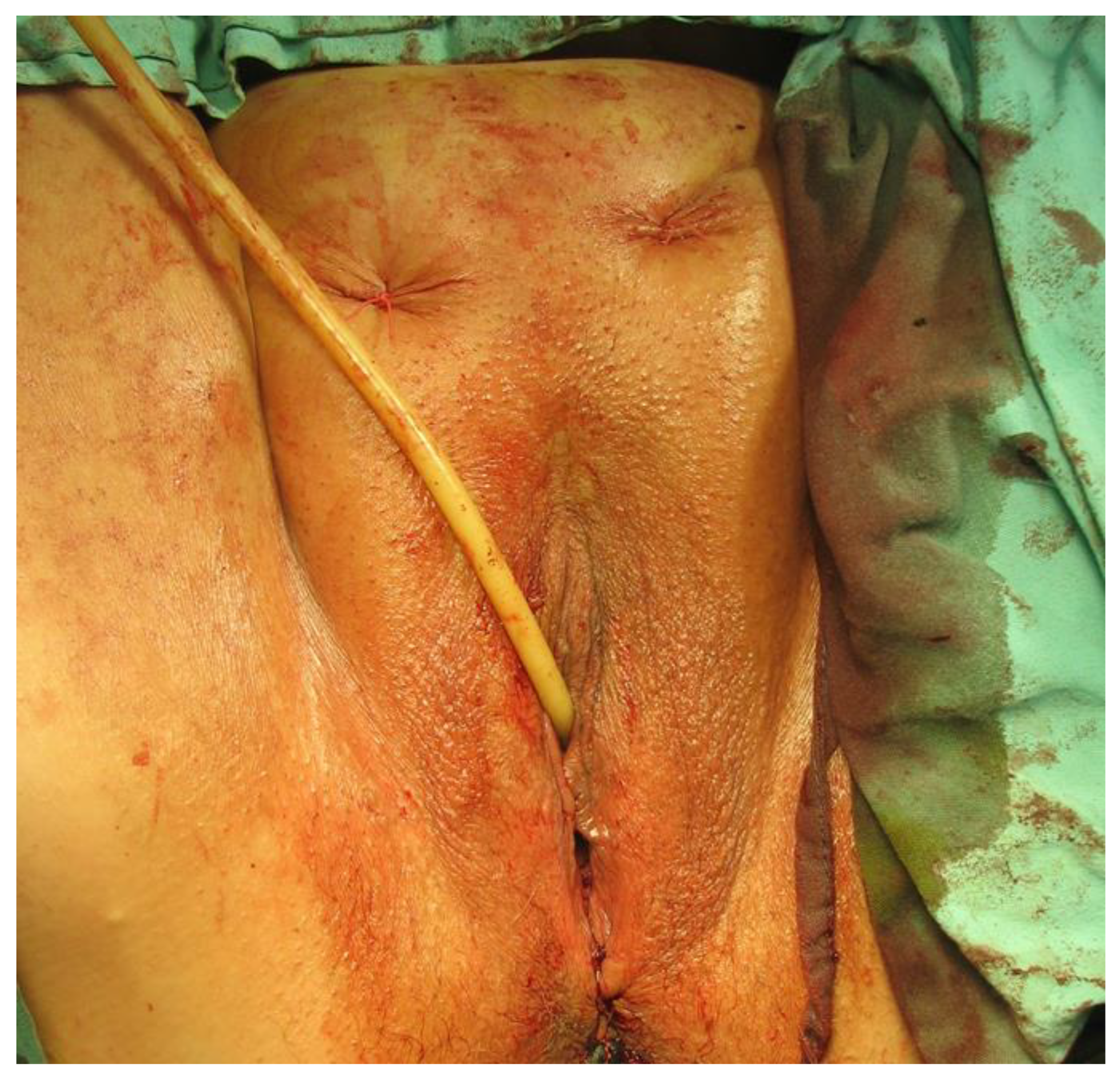 Diagnostics 14 00323 g004