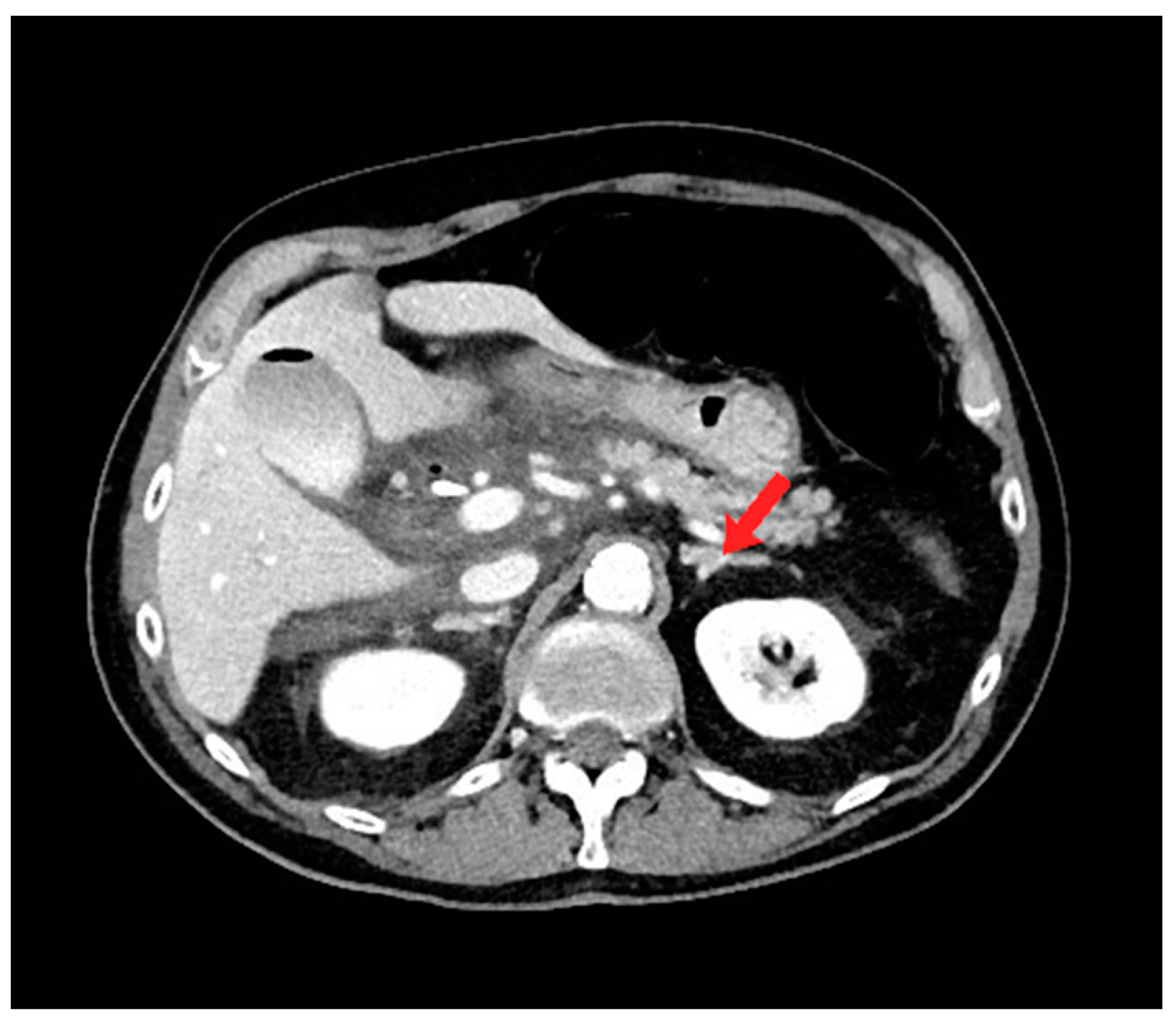 Diagnostics 14 00334 g001