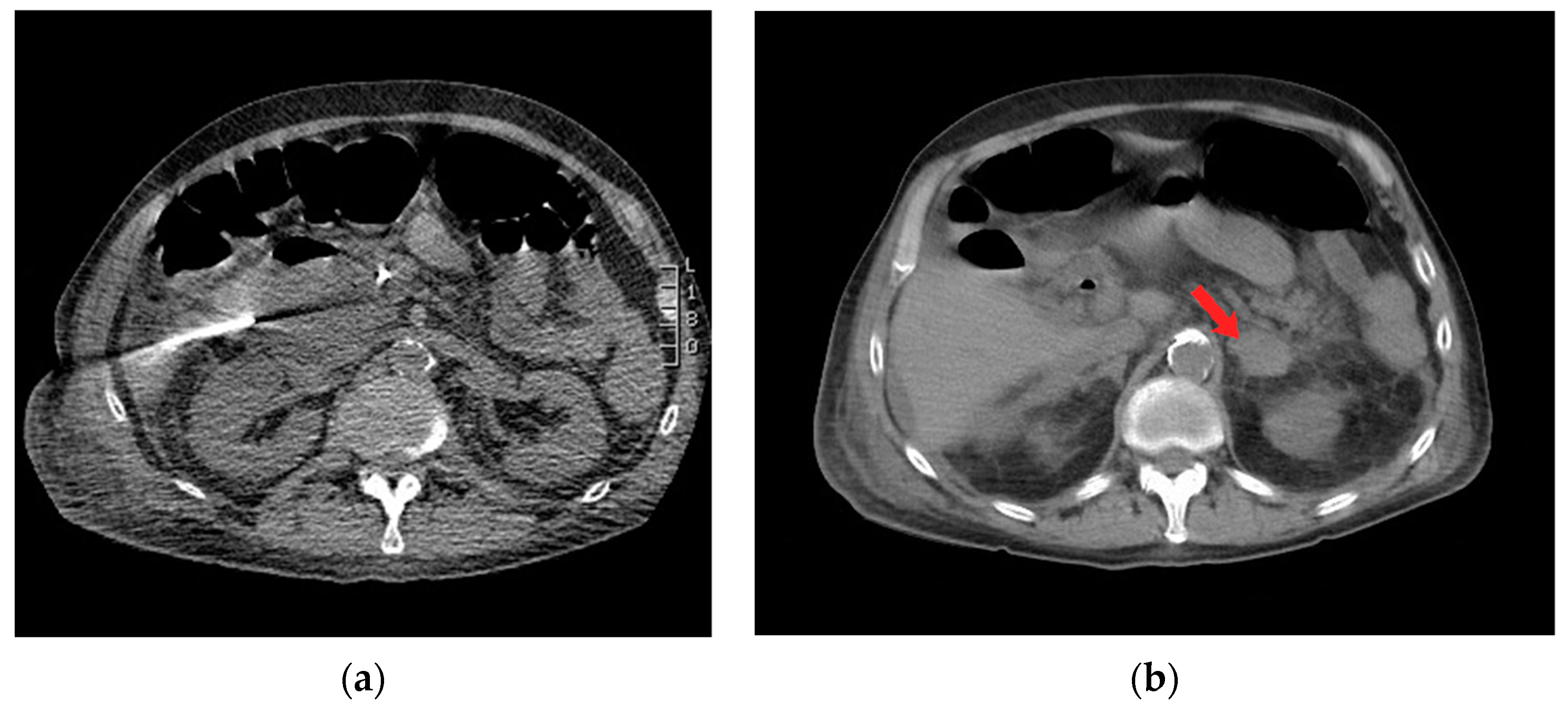 Diagnostics 14 00334 g002