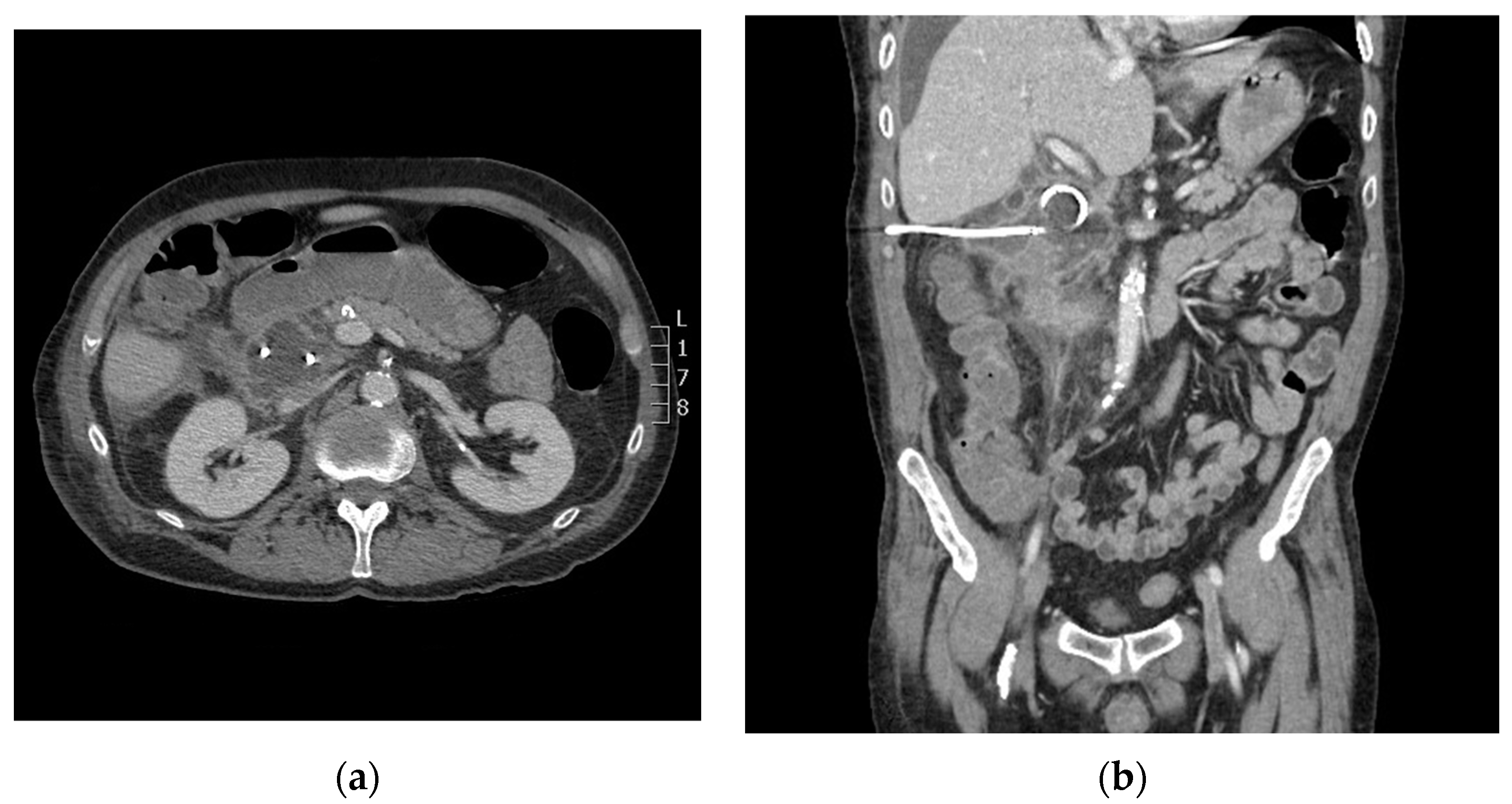 Diagnostics 14 00334 g003