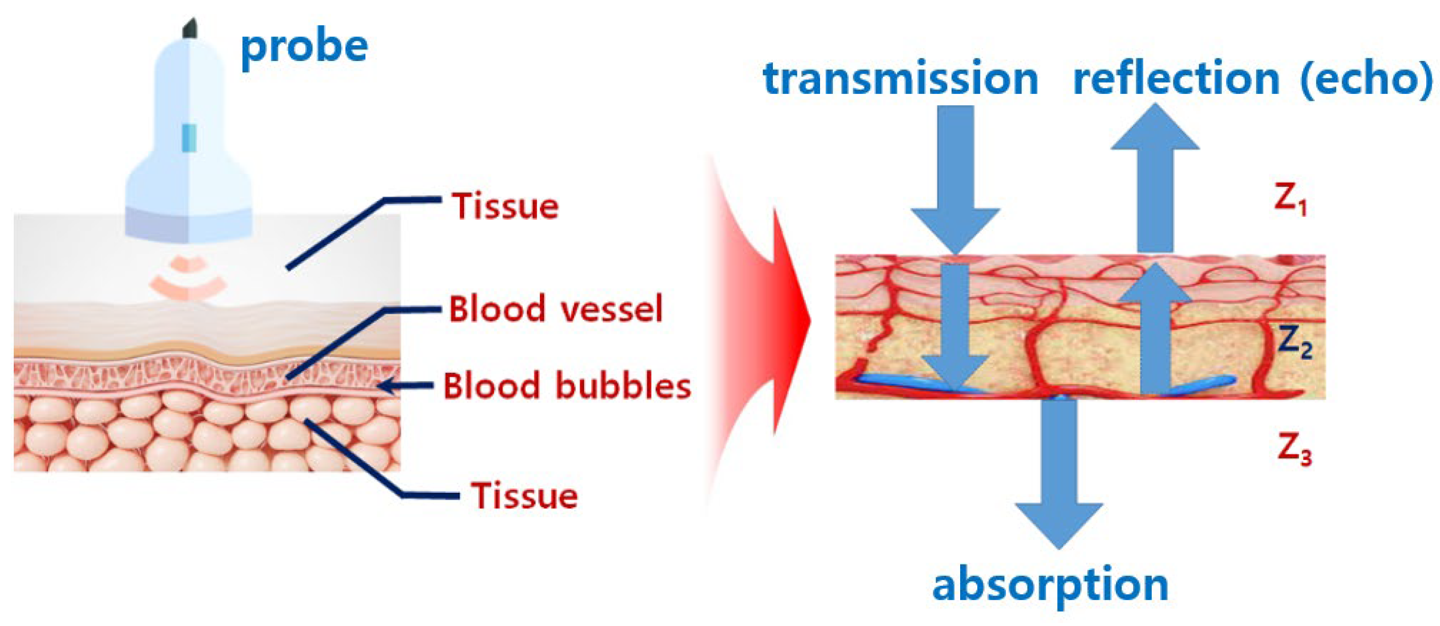 Diagnostics 14 00335 g001