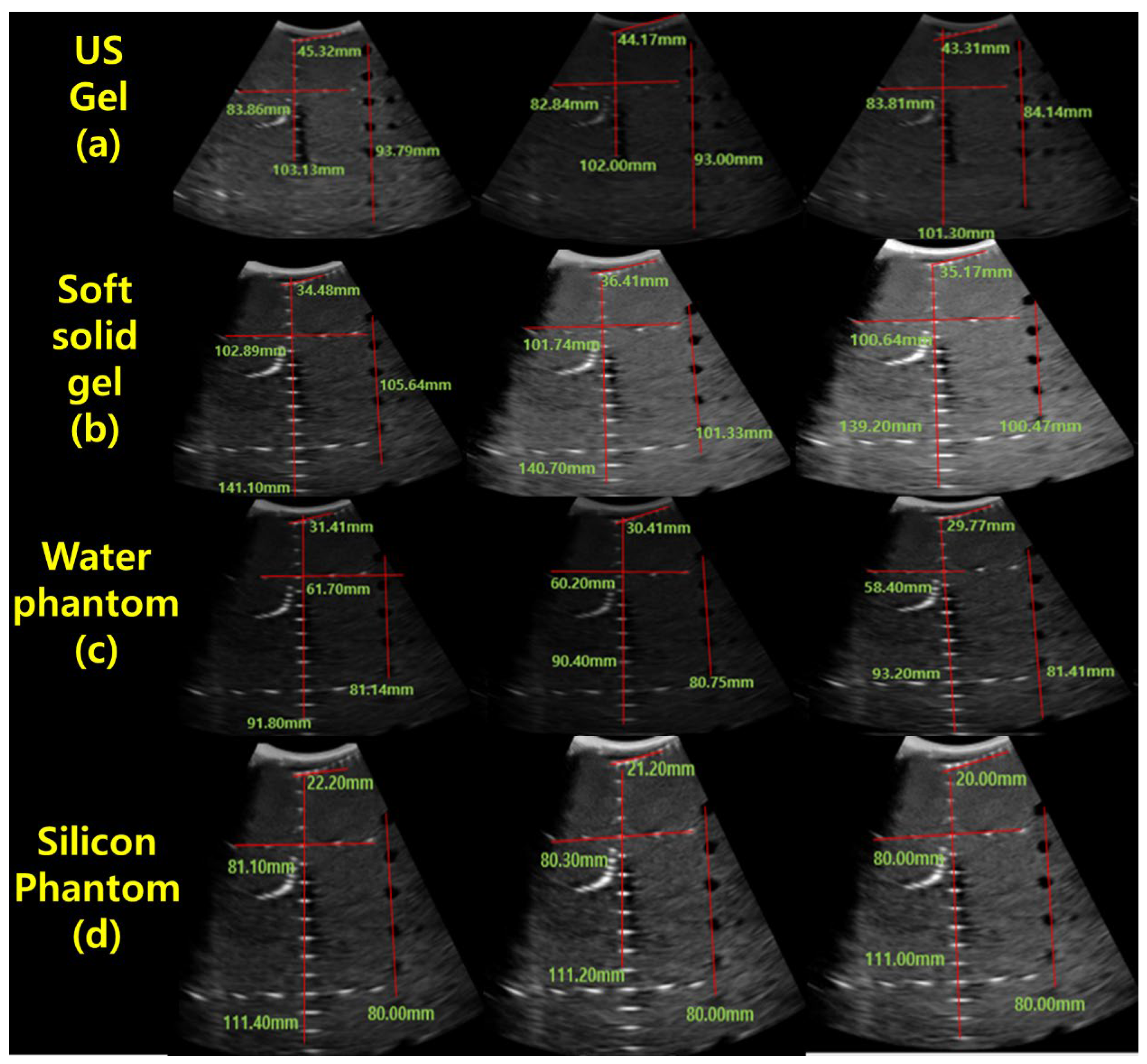 Diagnostics 14 00335 g009