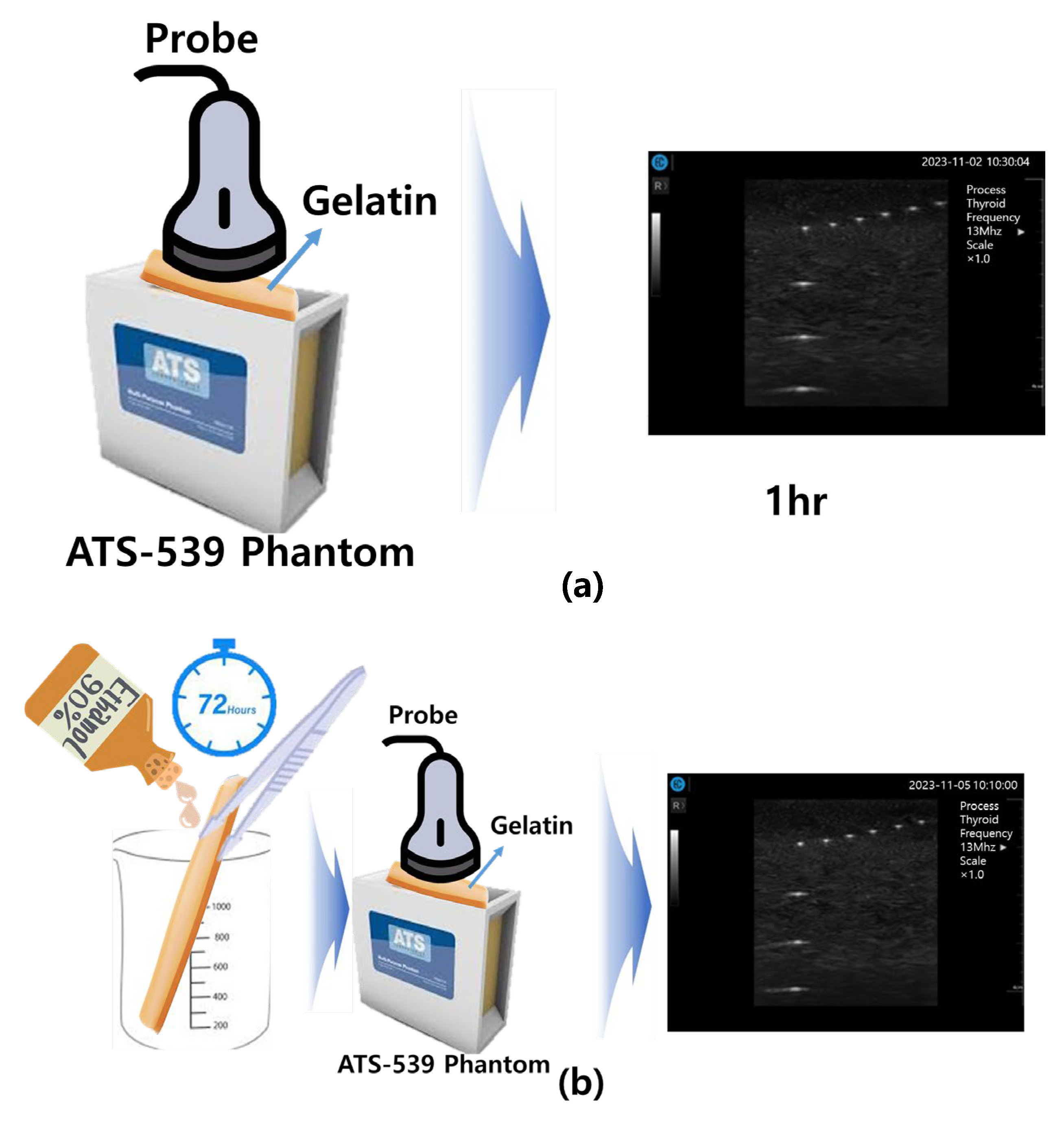 Diagnostics 14 00335 g015
