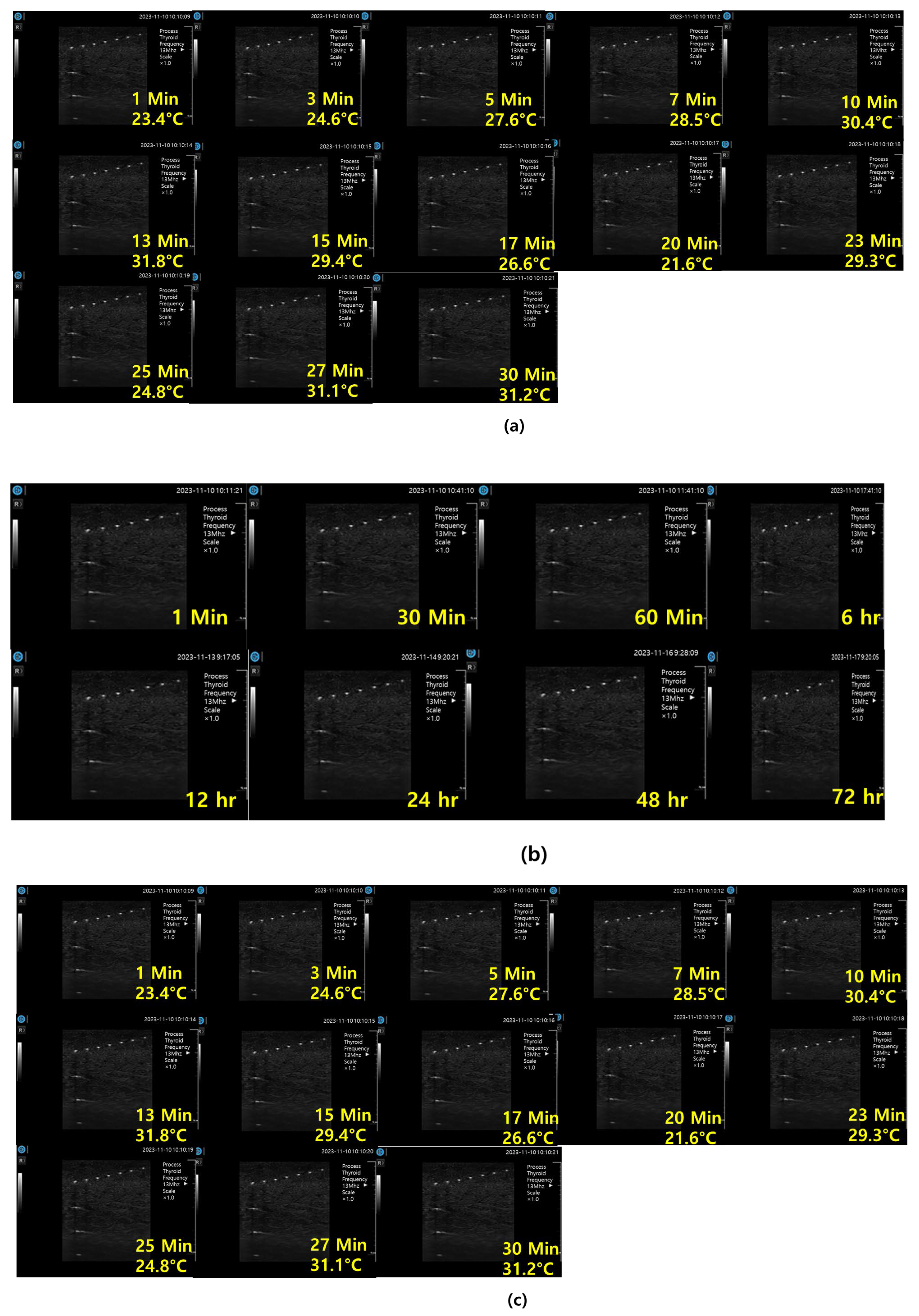 Diagnostics 14 00335 g016