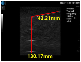 Diagnostics 14 00335 i001