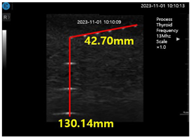 Diagnostics 14 00335 i002
