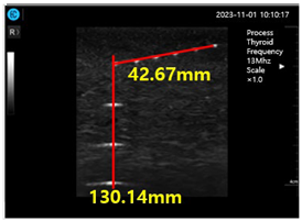 Diagnostics 14 00335 i003
