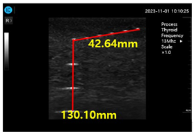 Diagnostics 14 00335 i004