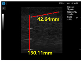 Diagnostics 14 00335 i005