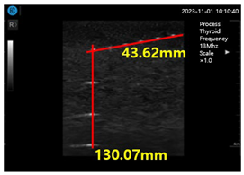 Diagnostics 14 00335 i006