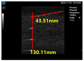 Diagnostics 14 00335 i007