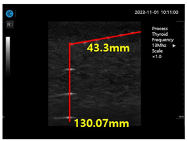 Diagnostics 14 00335 i008