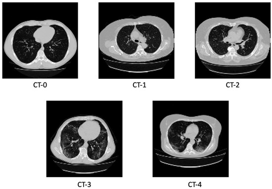 Diagnostics 14 00337 g0a1