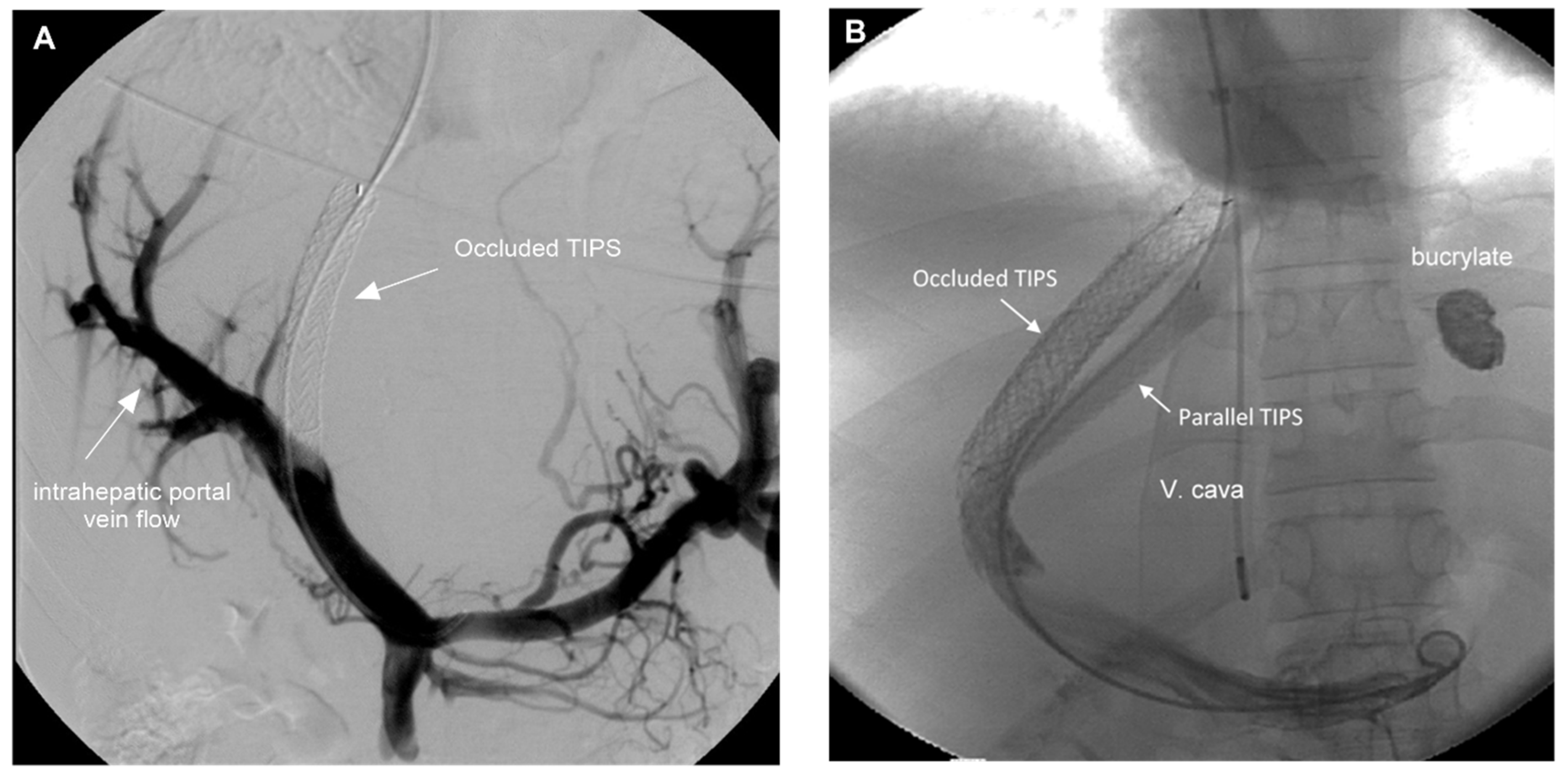 Diagnostics 14 00344 g001