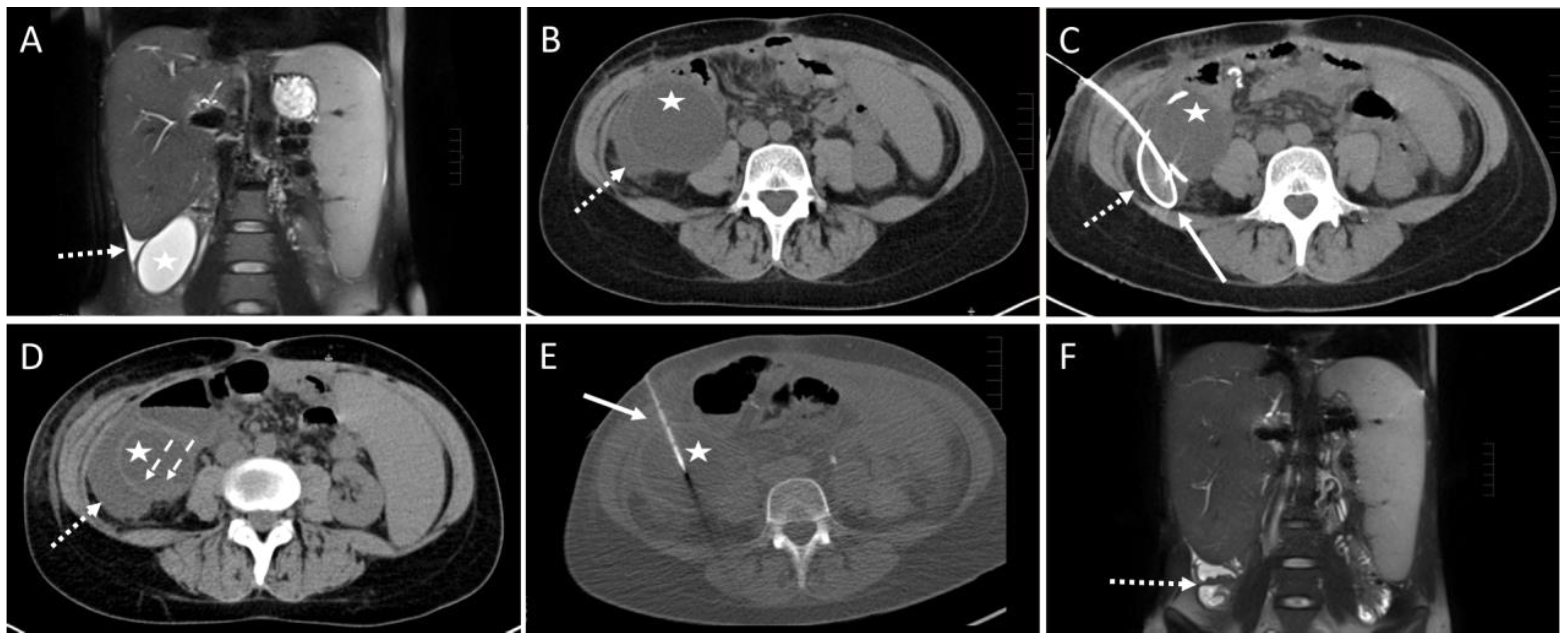 Diagnostics 14 00353 g003