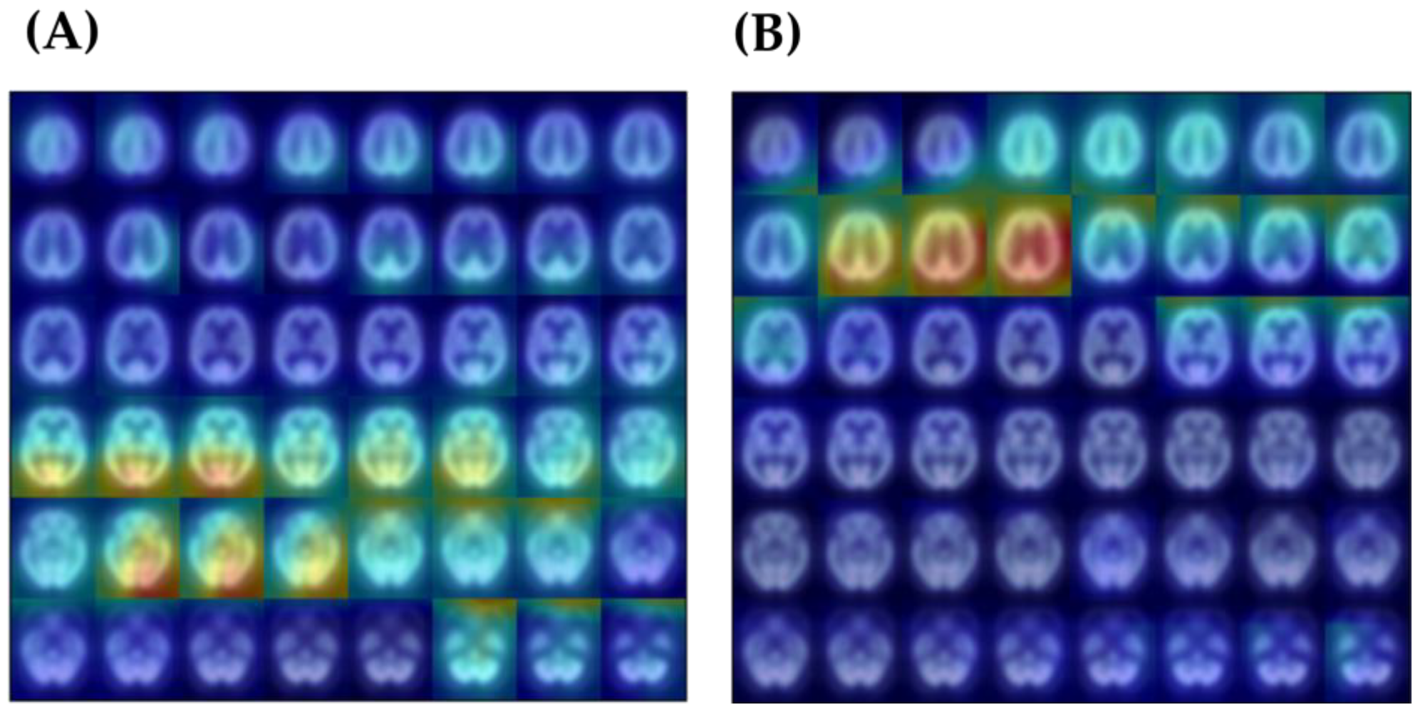Diagnostics 14 00365 g005