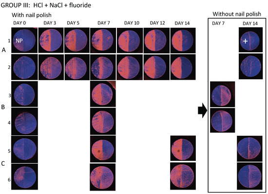 Diagnostics 14 00367 g0a3