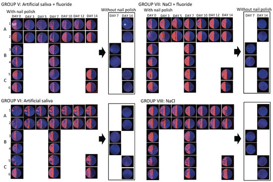 Diagnostics 14 00367 g0a5
