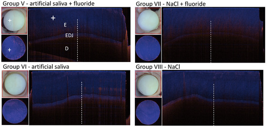 Diagnostics 14 00367 g0a6