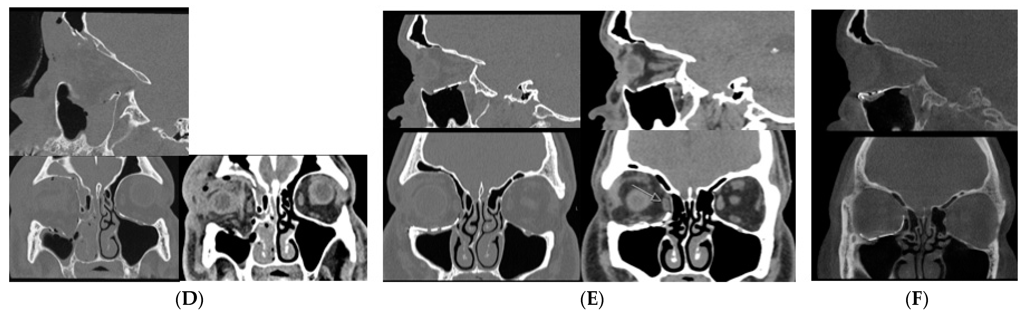 Diagnostics 14 00373 g005b Diagnostics 14 00373 g005b