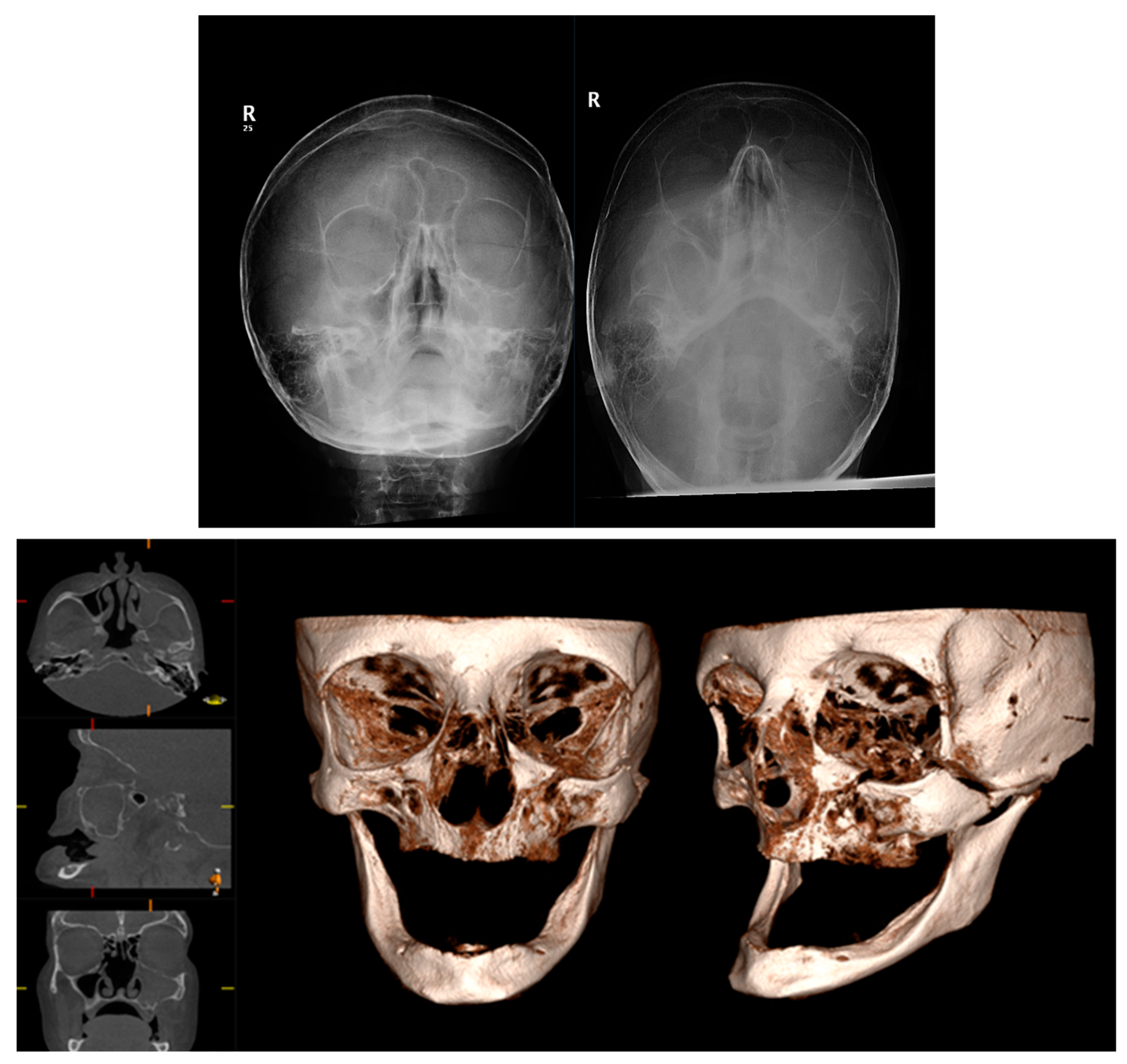 Diagnostics 14 00373 g006 Diagnostics 14 00373 g006