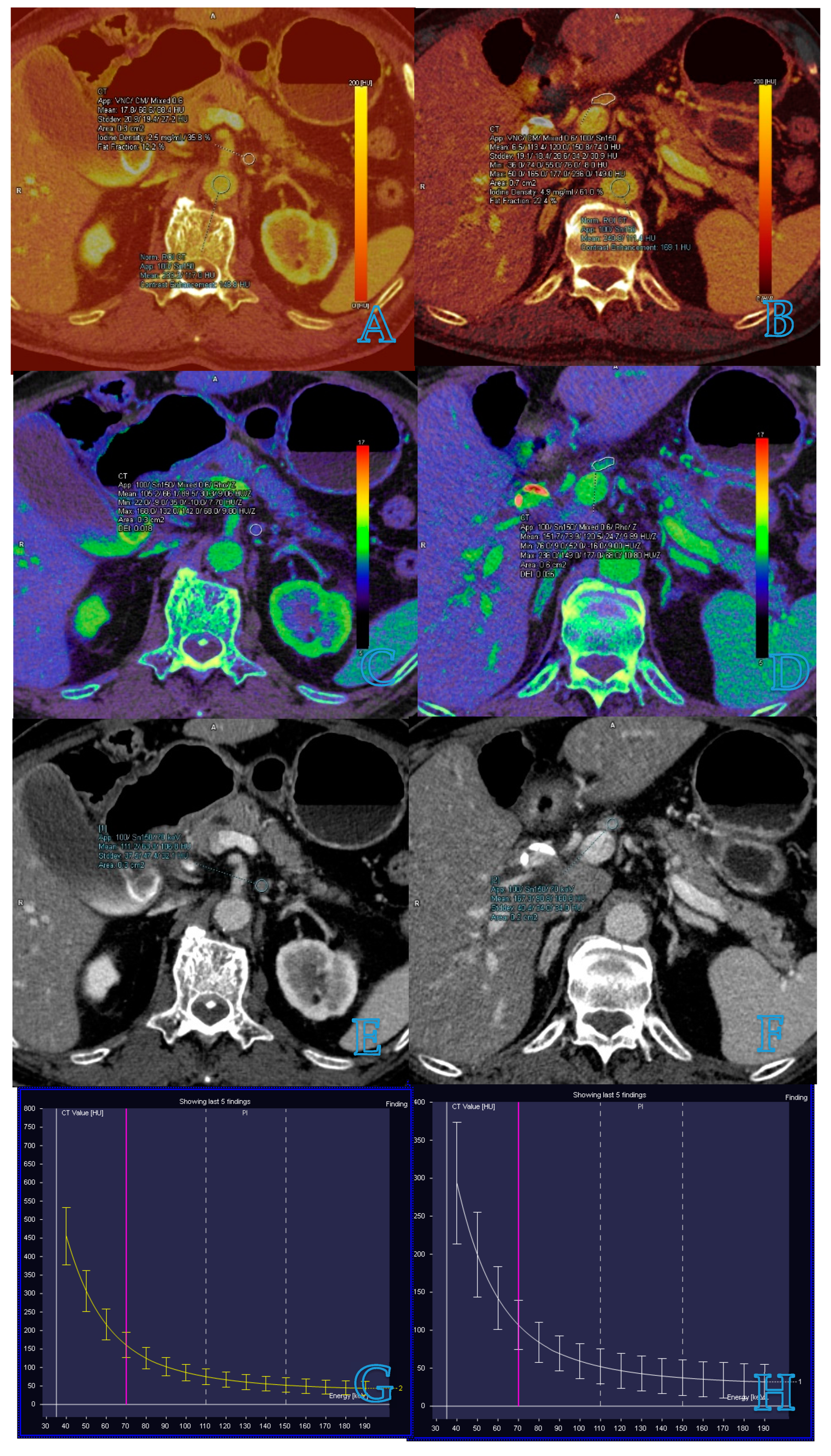 Diagnostics 14 00377 g001