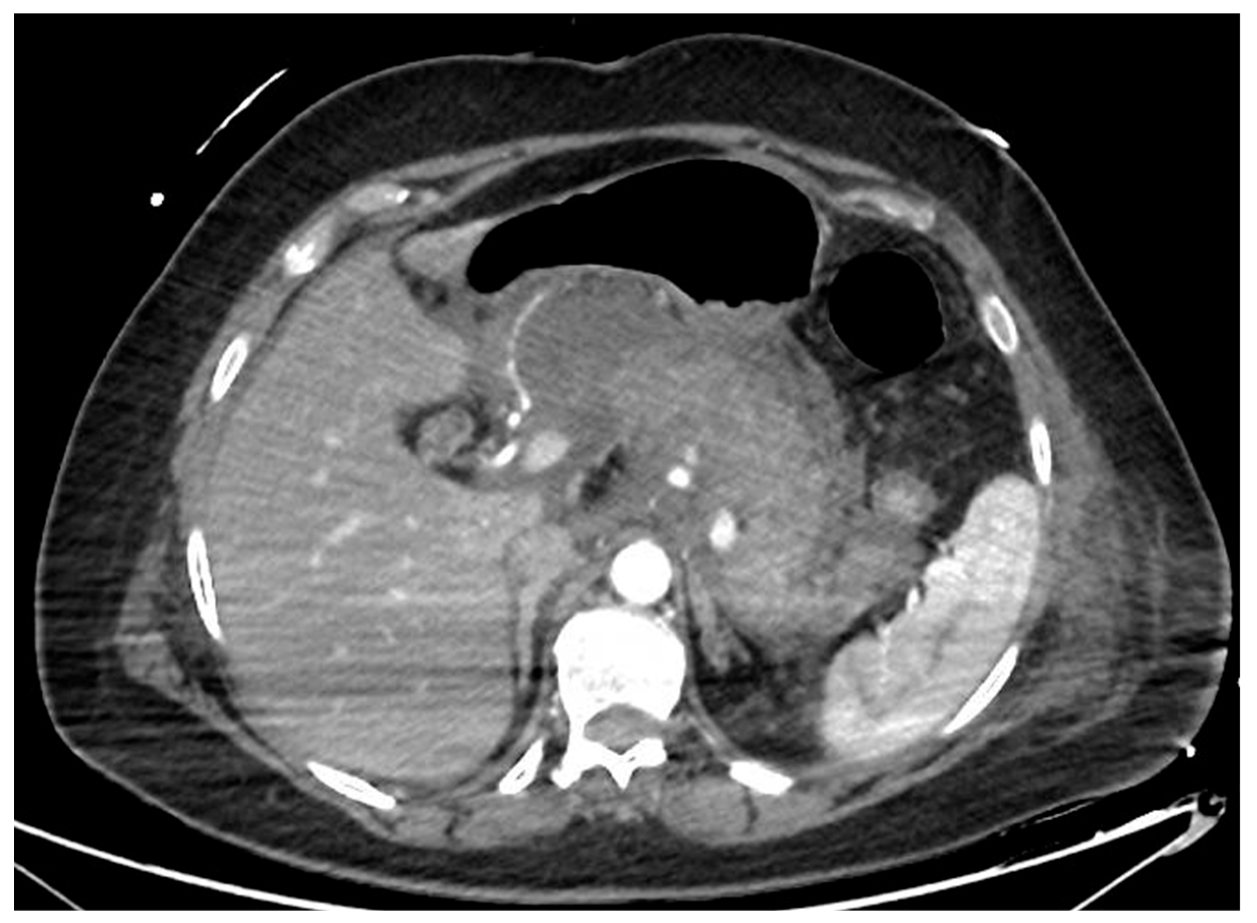 Diagnostics 14 00381 g001