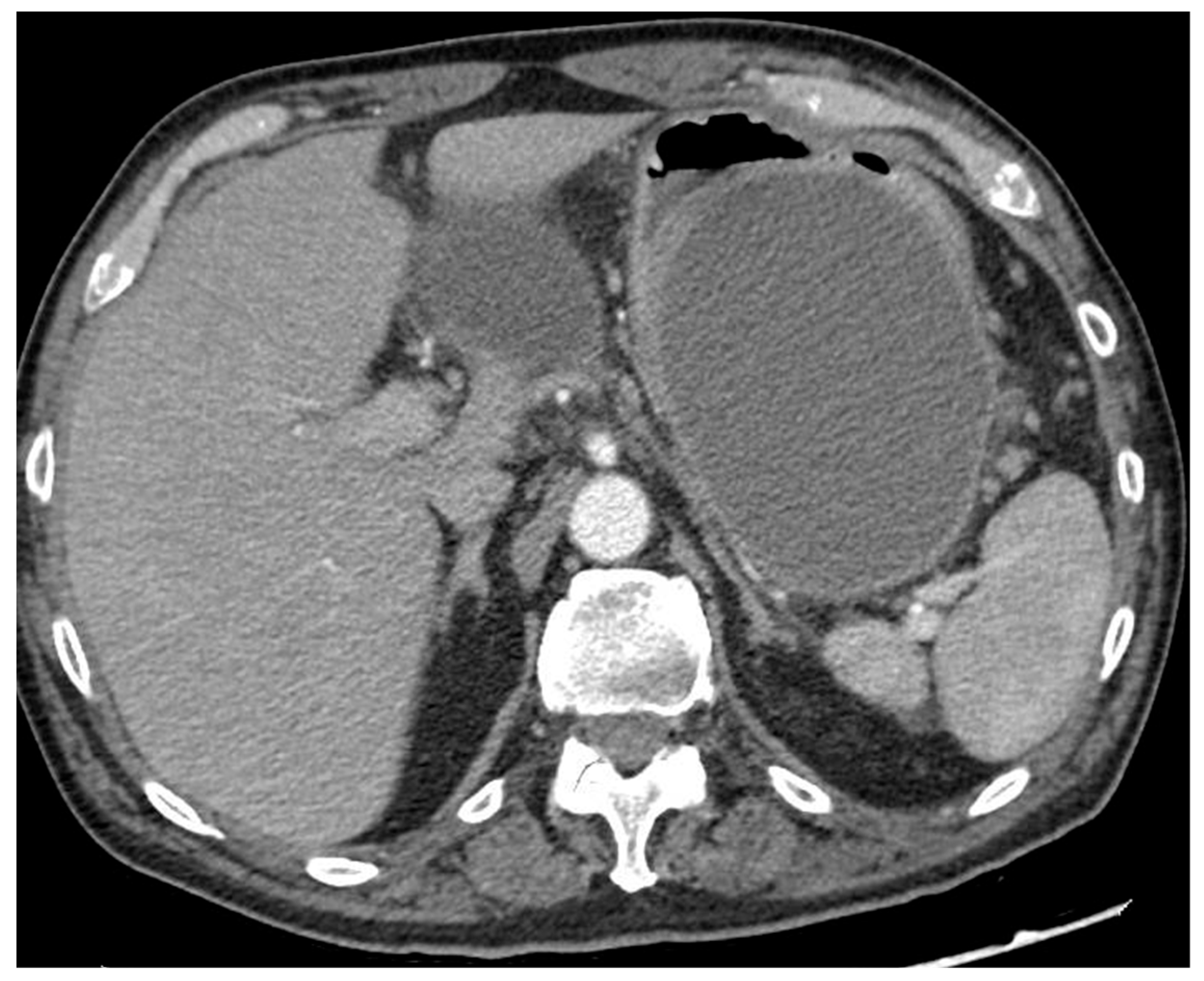 Diagnostics 14 00381 g002