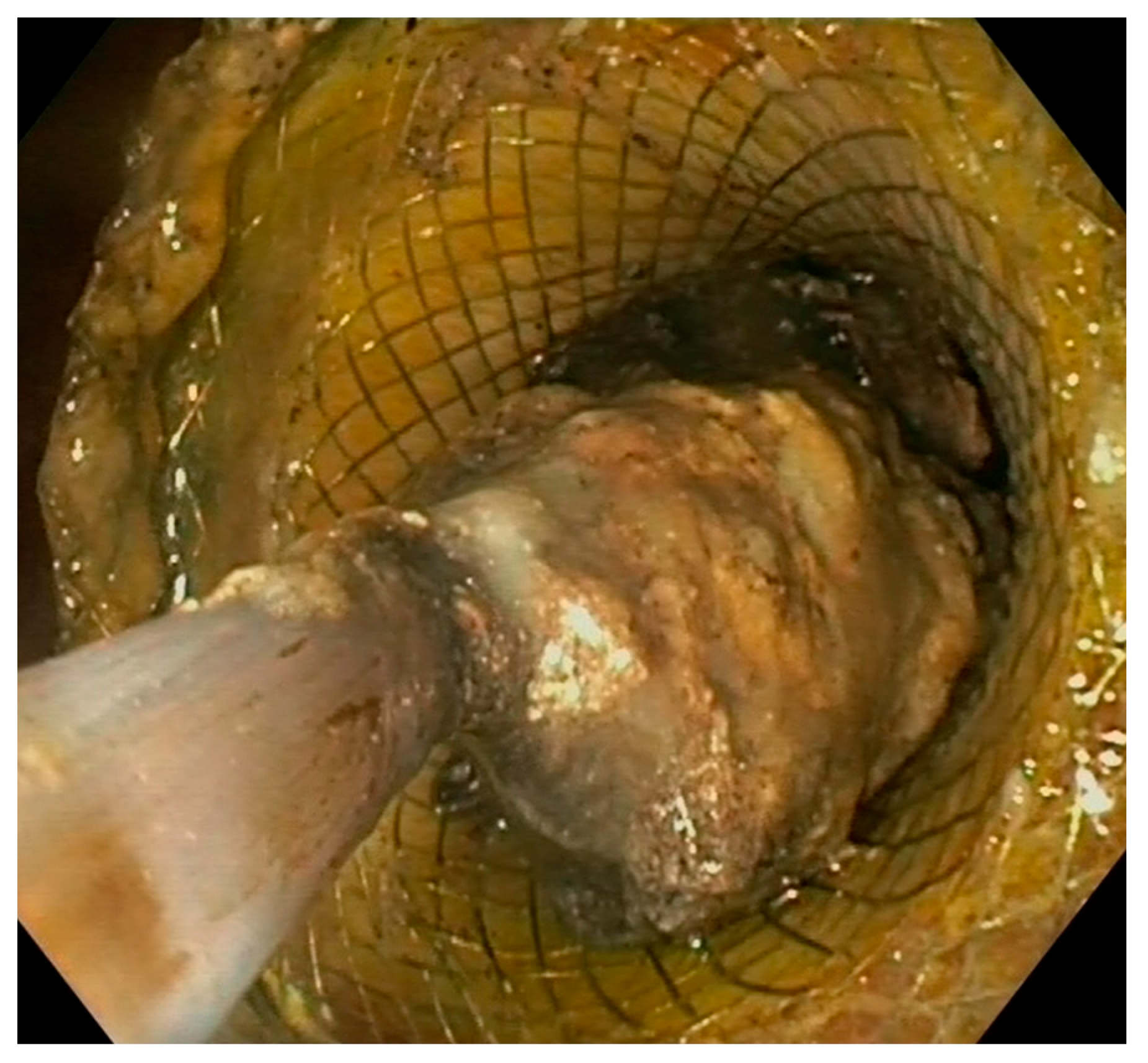 Diagnostics 14 00381 g005