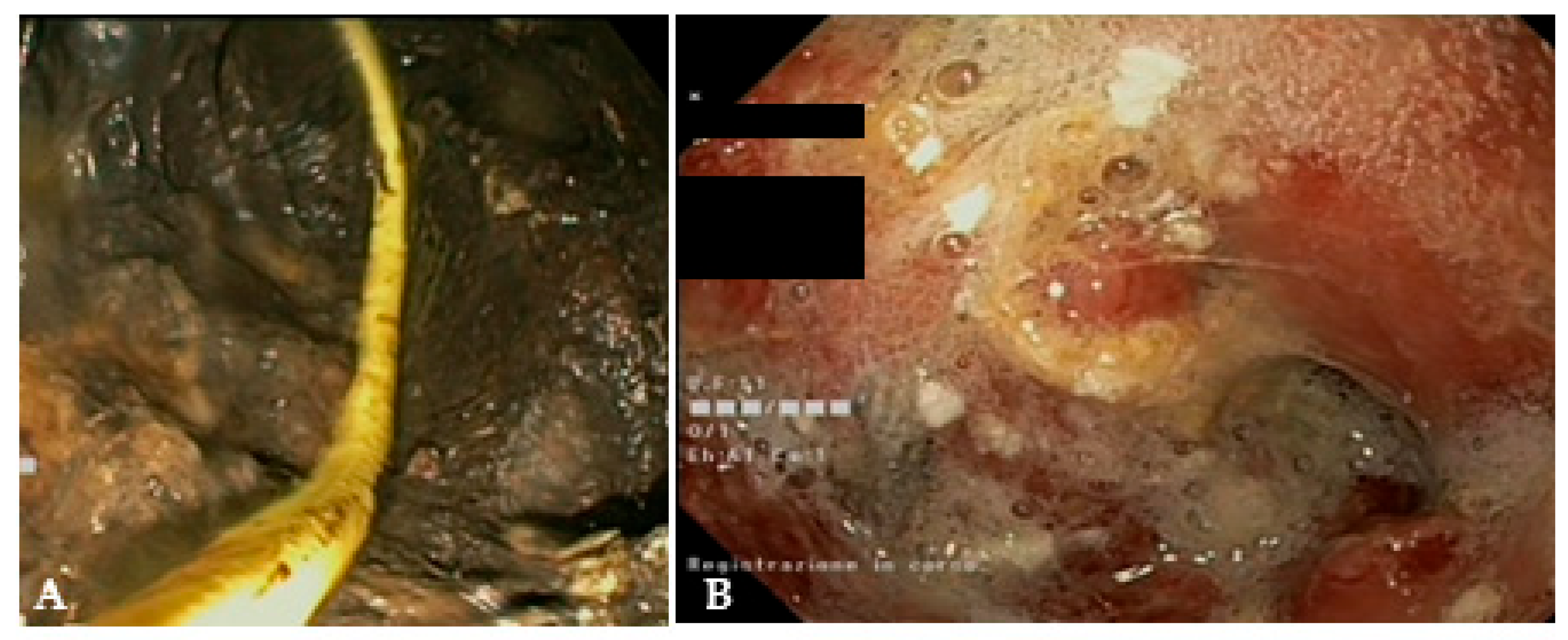 Diagnostics 14 00381 g006