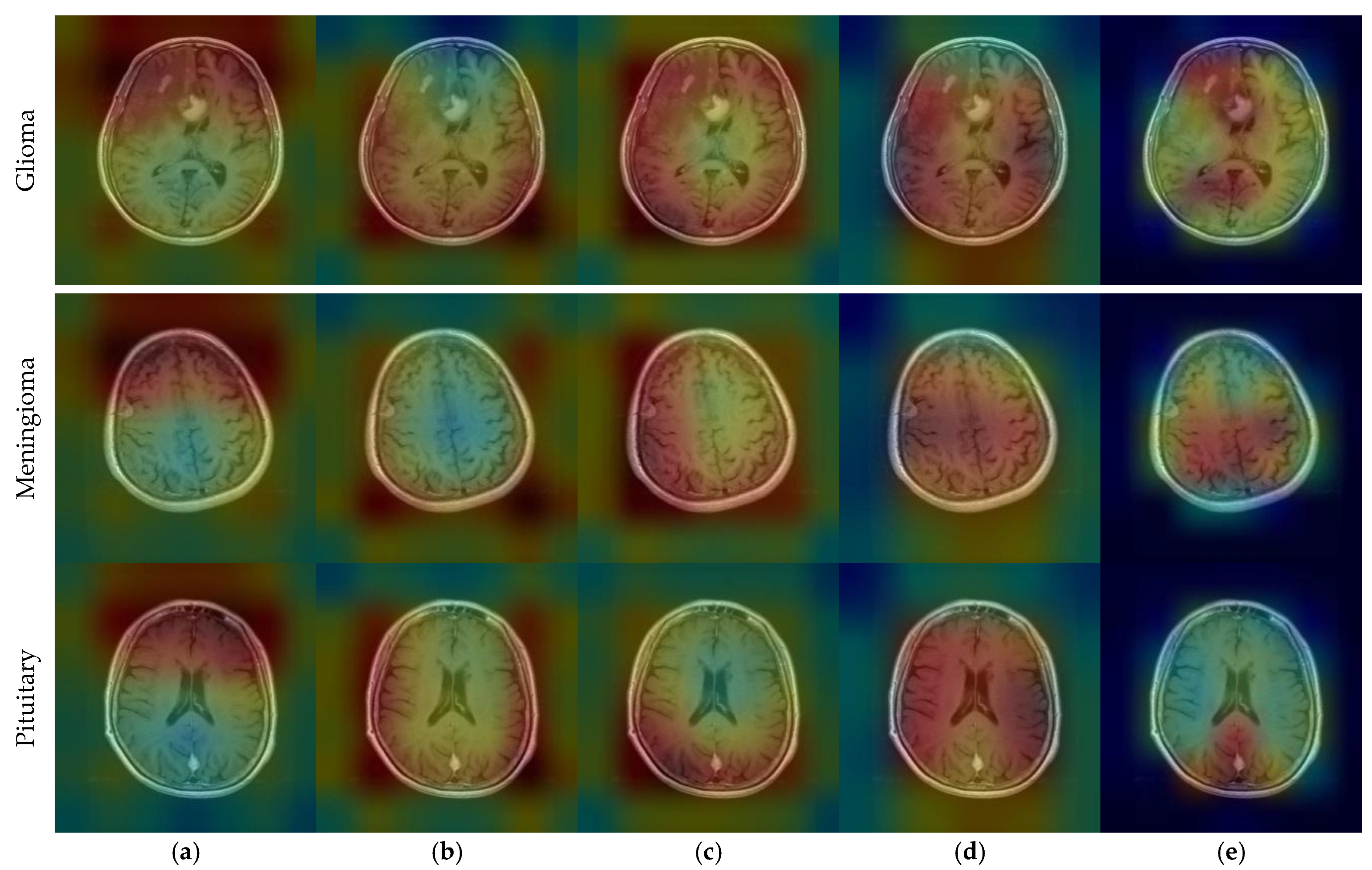Diagnostics 14 00383 g011