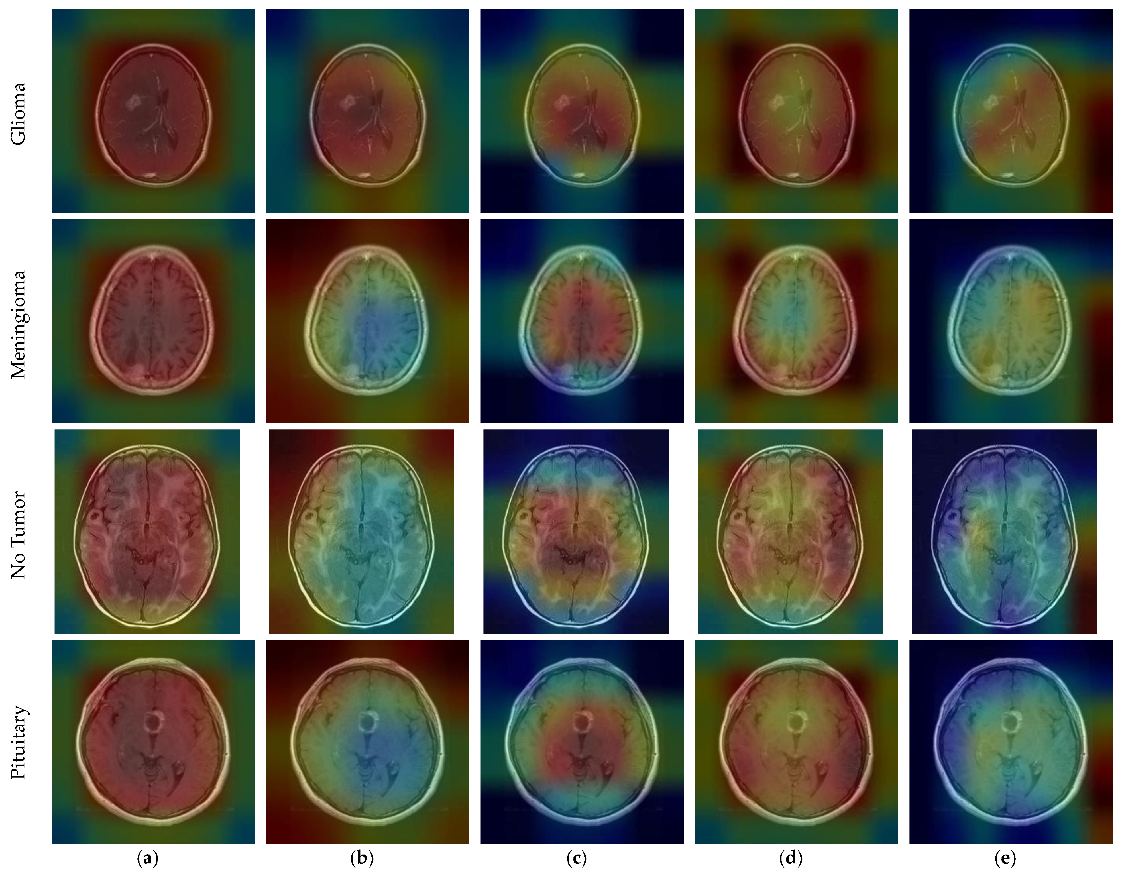 Diagnostics 14 00383 g012