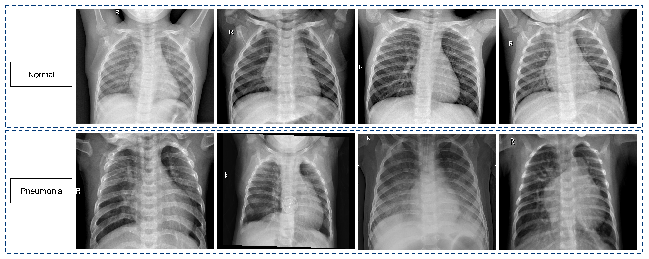 Diagnostics 14 00390 g002
